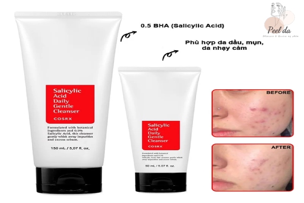Cosrx Salicylic Acid Daily Gentle Cleanser thích hợp cho làn da mụn