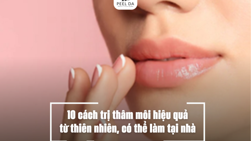 10 cách trị thâm môi hiệu quả từ thiên nhiên, có thể làm tại nhà